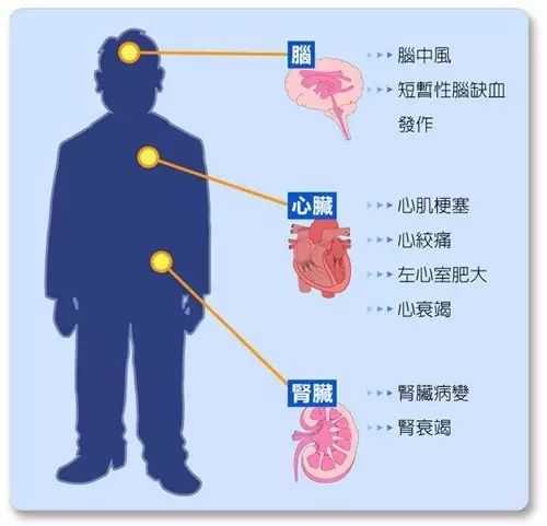 血压分为“高压”和“低压”，哪个指标超标更危险？