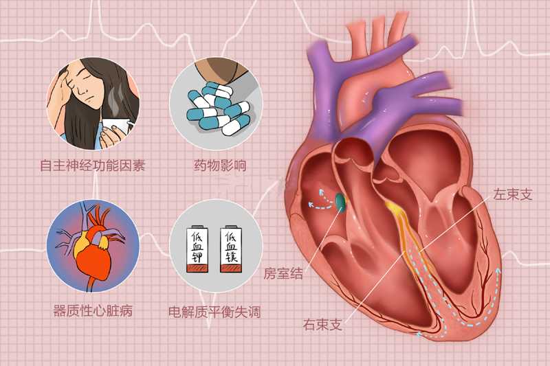 心脏早搏怎么治疗，5种药物用法要记牢！