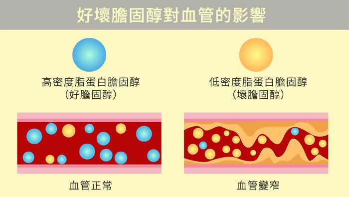 低密度脂蛋白胆固醇是心梗脑梗帮凶，它升高了怎么办？