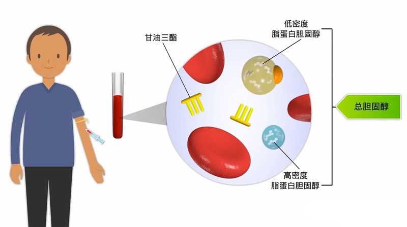 血脂超标，需要做哪些常规检查？