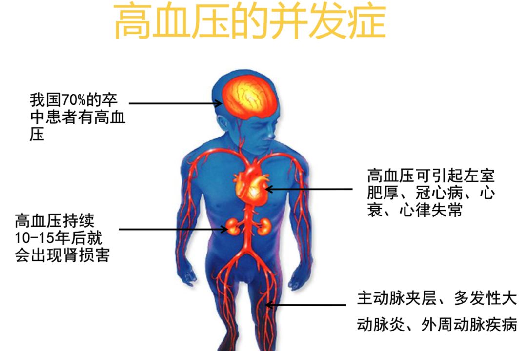 高血压生活管理指南，涉及方方面面！（建议收藏）