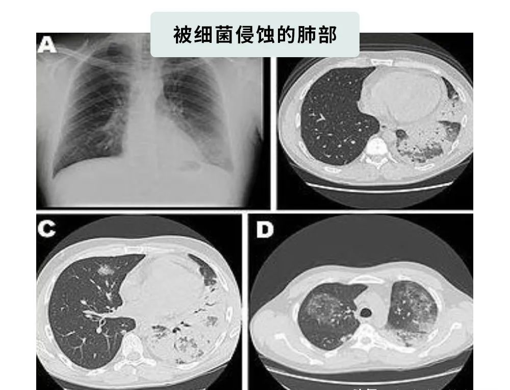 吹空调面瘫？吹空调差点猝死？空调病是因为你不正确使用空调！