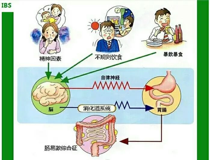 一紧张就会肚子痛，多半是肠易激综合征