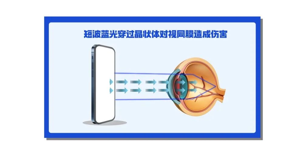 这6个日常不良习惯，会毁了眼睛！来看看你中招几个