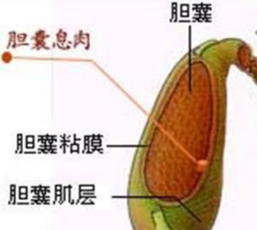 为什么会长胆囊息肉？体检发现胆囊息肉该怎么办？